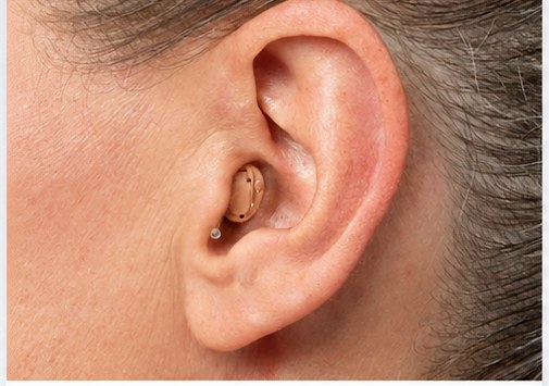 Auxiliar auditivo intracanal colocándose dentro del oído